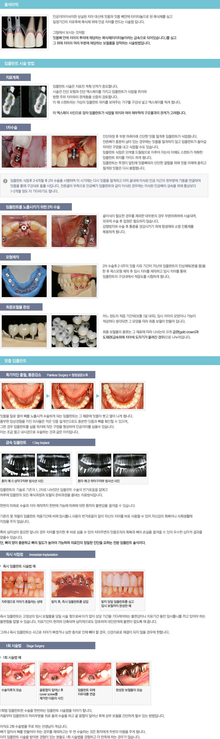 2d_implant.jpg