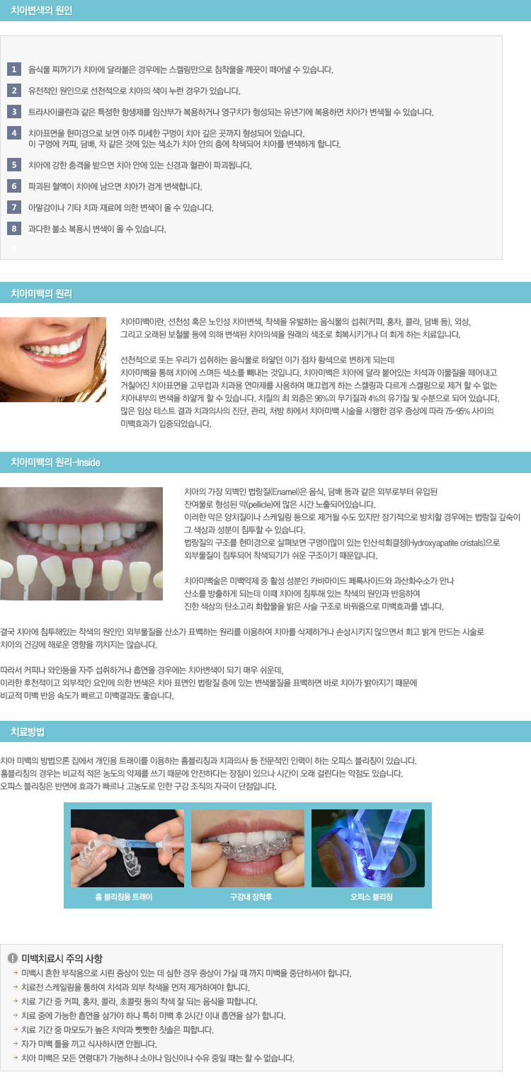 치아미백